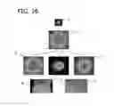 Fig. 15 - APPARATUS FOR MAKING ENGINEERED TISSUE USING SELF-ASSEMBLING CELL AGGREGATES