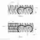 Fig. 07 - Nonwoven web with improved cut edge quality, and process for imparting