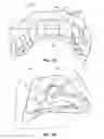 Fig. 02 - Anatomical healing abutments, kits, and methods