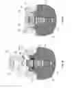 Fig. 09 - Dental retention systems