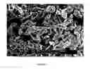 Fig. 02 - Immobilization of single site catalyst on inorganic oxide support for preparation of UHMWPE