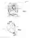 Fig. 02 - APICAL RING FOR VENTRICULAR ASSIST DEVICE