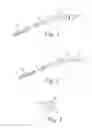 Fig. 02 - COVERED YANKAUER SUCTION DEVICE AND METHODS OF USING SAME
