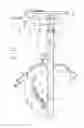 Fig. 02 - Fecal management appliance and method and apparatus for introducing same