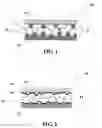 Fig. 02 - WATER-ABSORBENT SHEET STRUCTURE