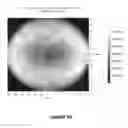 Fig. 22 - Systems and methods for the treatment of eye conditions