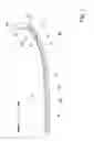 Fig. 02 - GUIDE CATHETER WITH AN ANCHORING MECHANISM AND METHOD FOR INTRODUCING GUIDE CATHETER