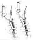 Fig. 02 - Functional uterine manipulator