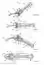 Fig. 06 - Functional uterine manipulator