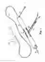 Fig. 02 - ATHERECTOMY DEVICE HAVING COMBINED OPEN/CLOSE DRIVE SHAFT