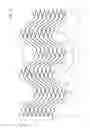 Fig. 02 - Highly flexible stent with sinusoidal pattern