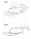 Fig. 03 - Intraocular lens