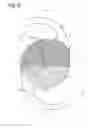Fig. 04 - Intraocular lens