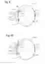 Fig. 06 - Intraocular lens