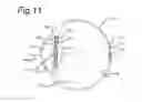 Fig. 07 - Intraocular lens