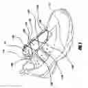 Fig. 02 - Tension limiting mechanisms for closure devices and methods therefor