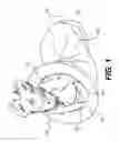 Fig. 02 - Washable, Collapsible Pet Bed