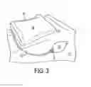 Fig. 04 - Patient positioning system