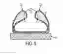 Fig. 06 - Patient positioning system