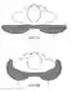Fig. 12 - Patient positioning system