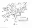 Fig. 17 - Patient positioning system