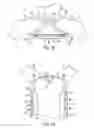 Fig. 18 - Patient positioning system