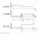 Fig. 07 - Method of separating and recovering metals and system for separating and recovering metals