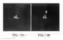 Fig. 10 - Charged particle beam system and method of operating a charged particle beam system