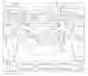 Fig. 01 - Fifth wheel trailer safety device