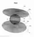 Fig. 07 - Magnetic field homogeneity adjustment method, magnet device, and magnetic resonance imaging apparatus