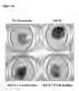 Fig. 02 - Compositions and methods for treating inflammation and fibrosis