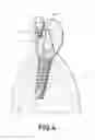 Fig. 08 - Dental post for supporting dental prostheses and method for the production thereof