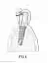 Fig. 09 - Dental post for supporting dental prostheses and method for the production thereof