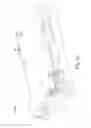 Fig. 16 - Mechanism for generating an orbital motion or a rotation motion by inversing a drive direction of a drive unit