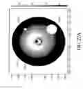 Fig. 22 - Hepatic neuromodulation using microwave energy