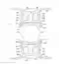 Fig. 01 - Semi-rigid framework for a plate haptic intraocular lens