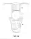 Fig. 04 - Semi-rigid framework for a plate haptic intraocular lens