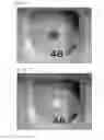 Fig. 04 - Concentration measuring device