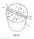 Fig. 28 - Tank dampening device