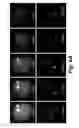 Fig. 10 - DEVICES AND METHODS FOR DETERMINING SENSITIVITY TO RADIATION