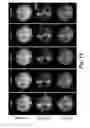 Fig. 19 - DEVICES AND METHODS FOR DETERMINING SENSITIVITY TO RADIATION