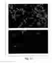 Fig. 04 - BACTERIAL MEDIATED THF ALPHA GENE SILENCING