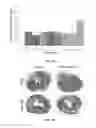 Fig. 06 - Methods for treating cardiac conditions
