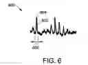 Fig. 05 - Methods, systems, and apparatus for neural signal detection