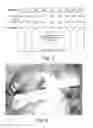 Fig. 06 - Neural analysis and treatment system