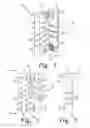 Fig. 02 - Flexible and static interspinous/inter-laminar spinal spacers