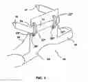 Fig. 02 - Head and Neck Support Device