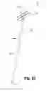 Fig. 07 - Pole cleaning apparatus