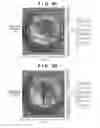 Fig. 06 - Radiation imaging apparatus, method of manufacturing the same, and radiation inspection apparatus