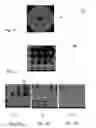 Fig. 05 - Method of producing a Fresnel Zone Plate for applications in high energy radiation